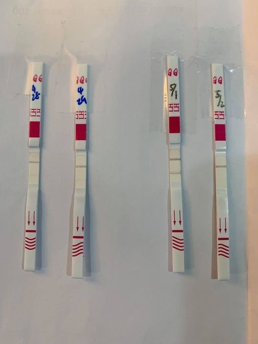 多囊用排卵試紙有效嗎?